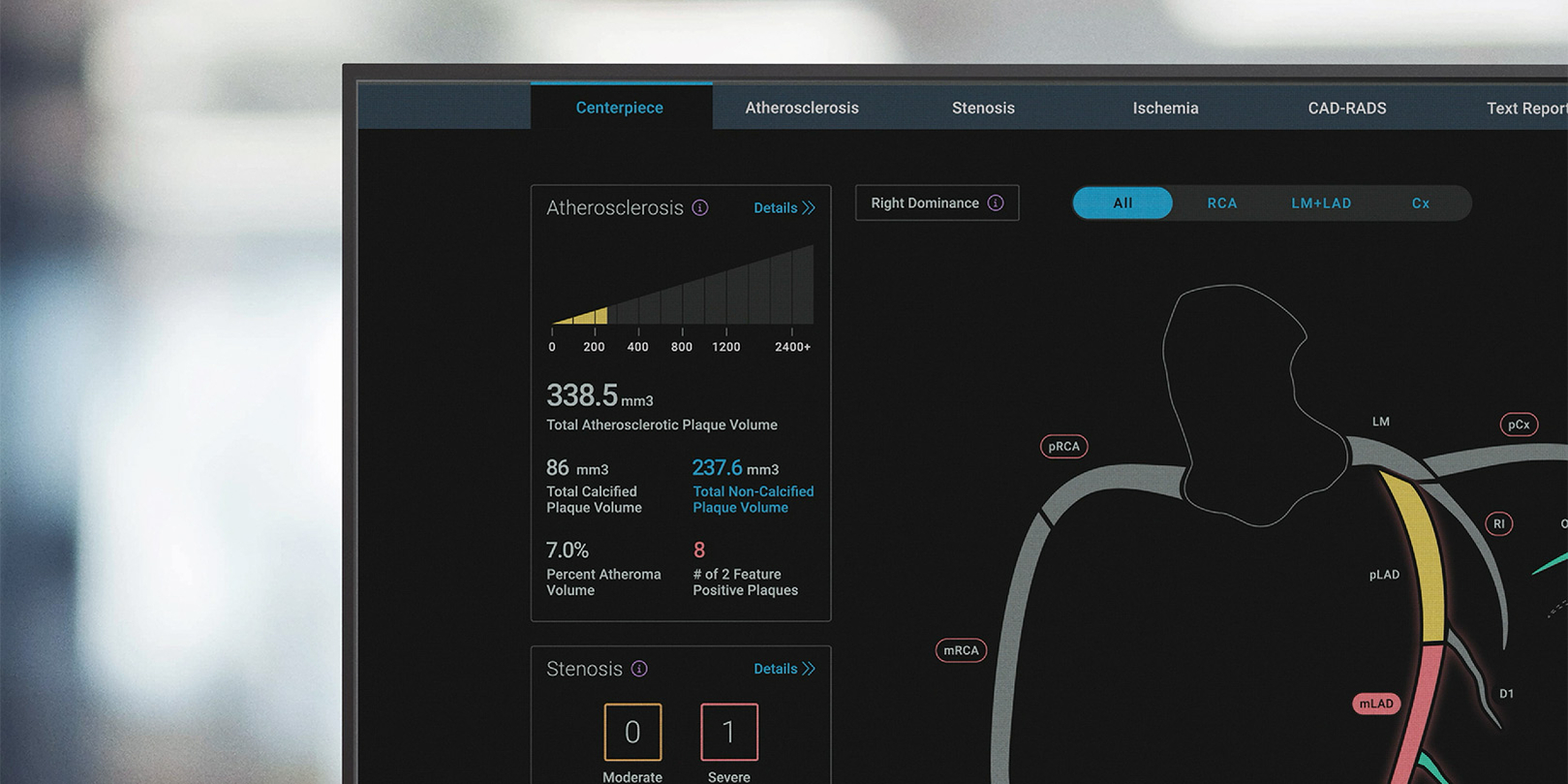 cleerly-individuals---heart-analysis