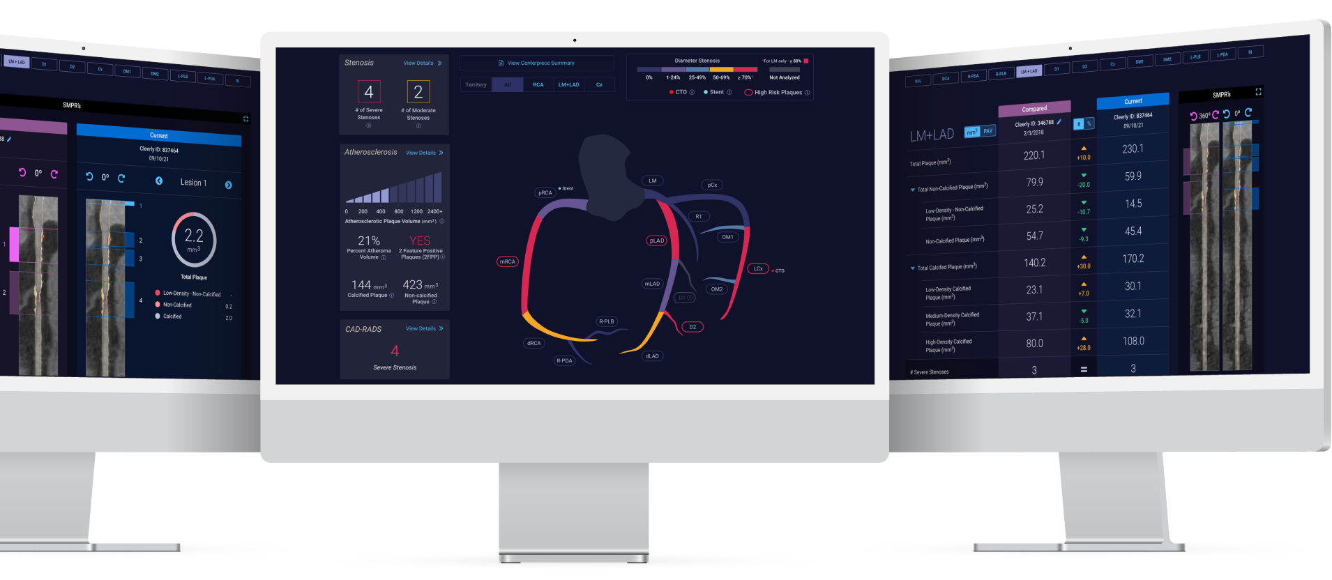 Cleerly Labs - Heart Disease Technology Product