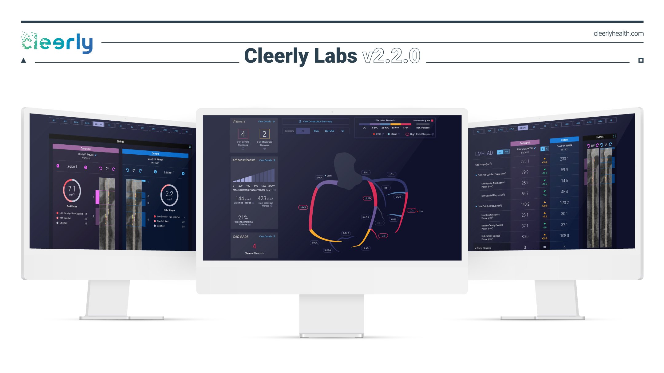 Cleerly-v2.2.0-Screen-Renderings