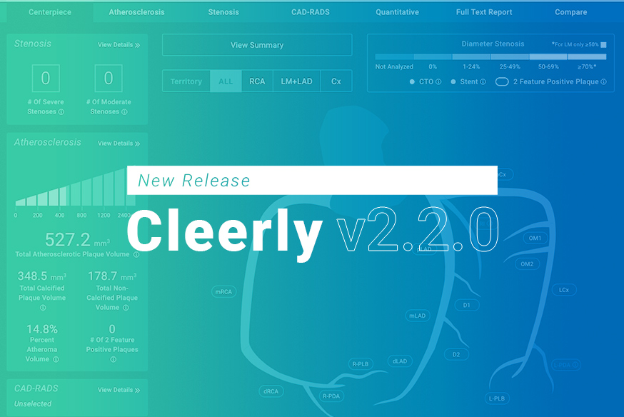 Cleerly Releases Software Update v2.2.0