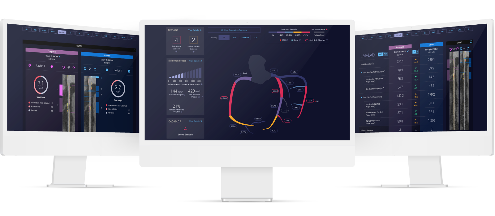 Cleerly's comprehensive whole-heart analysis tools